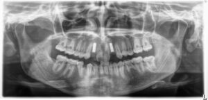 3D Imaging
