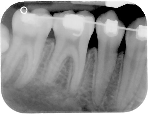 Copy+of+Sheline+post-op+PA (2)