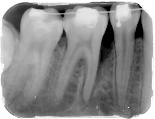 Copy+of+Sheline+pre-op2 (1)