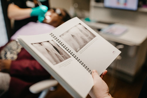 Tooth Socket Bone Preservation