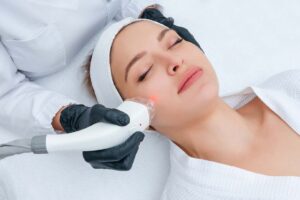 SmoothLase Treatment